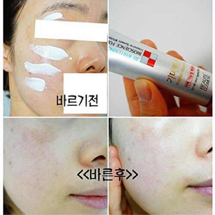 Kem dưỡng Melasma-X 3D Whitening Clinic Cream giúp làm trắng da và giảm nám tàn nhang