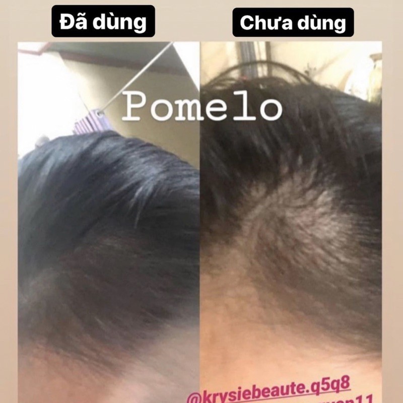 POMELO - xịt bưởi kích mọc tóc nhanh dài | BigBuy360 - bigbuy360.vn