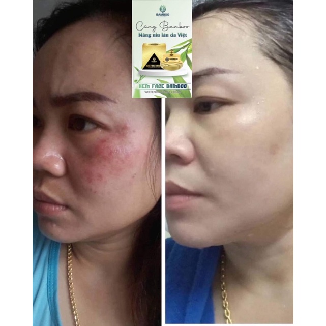 🎋𝗖𝗵𝗶́𝗻𝗵 𝗛𝗮̃𝗻𝗴 𝗕𝗮𝗺𝗯𝗼𝗼-𝗚𝗶𝗮́ 𝗖𝘁𝘆🎋Set Kem Face+Serum Bamboo - dưỡng trắng nhanh,căng bóng