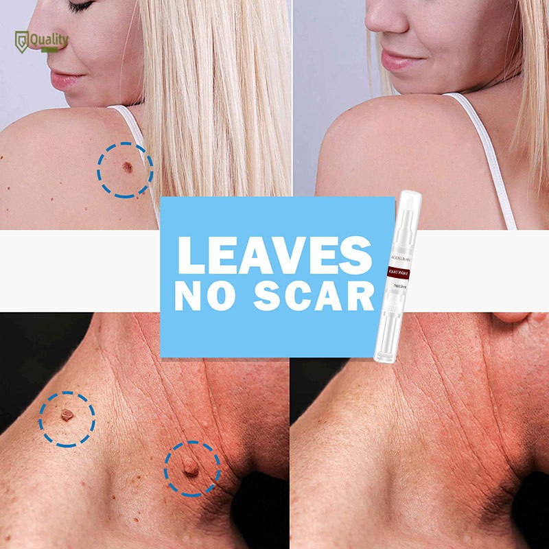Dung dịch loại bỏ mụn thịt dư an toàn hiệu quả 13ml