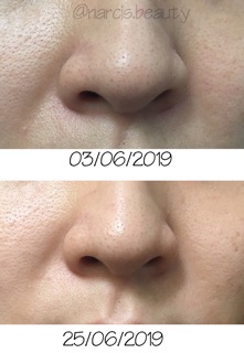 Nước cân bằng PIXI glow tonic