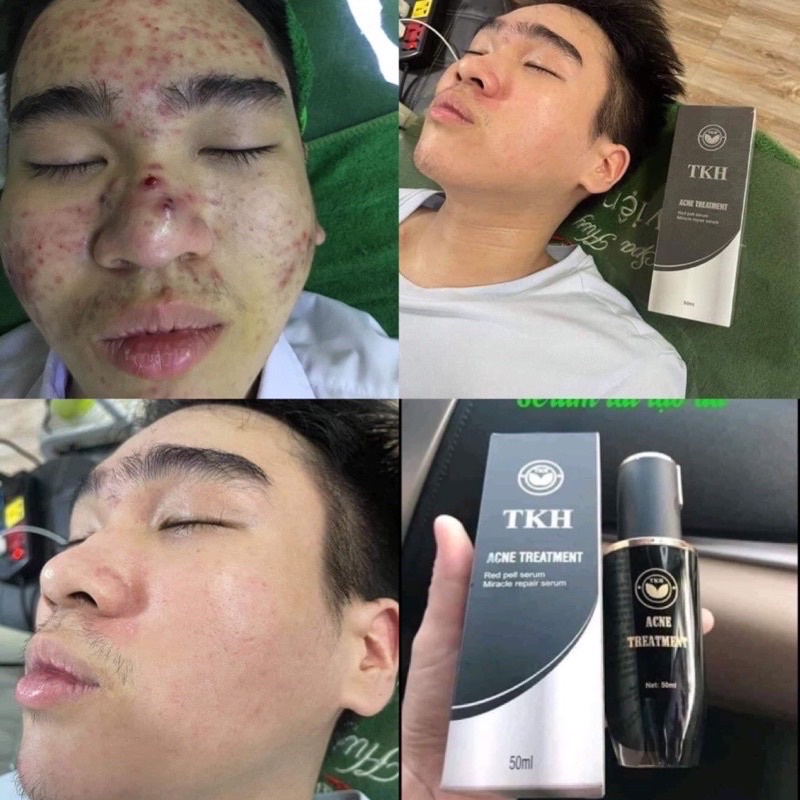 SERUM TÁI TẠO TRẦN KIM HUYỀN