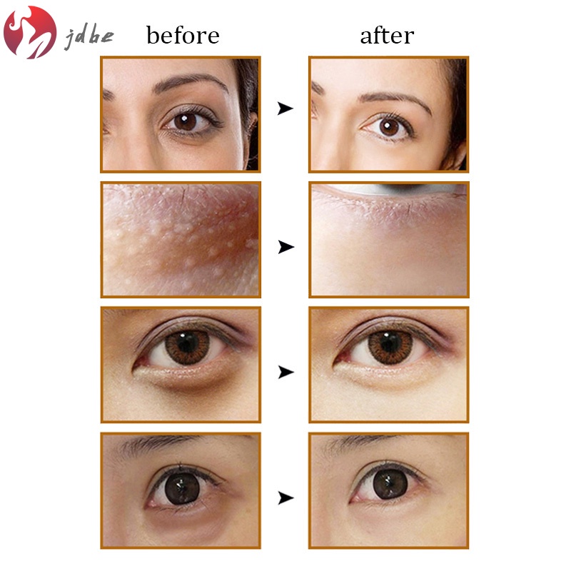 1 kem dưỡng da mắt JDBE loại bỏ quầng thâm và bọng mắt làm săn chắc da dưỡng ẩm
 | BigBuy360 - bigbuy360.vn