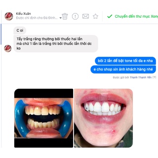 thuốc tẩy trắng răng