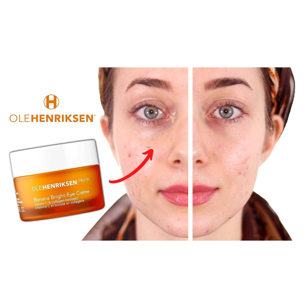 Kem mắt Ole Henriksen Banana Bright Eye Creme Unbox 7ml