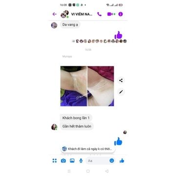 Vi kjm thảo dược hũ lớn 50gr mẫu mới nhất