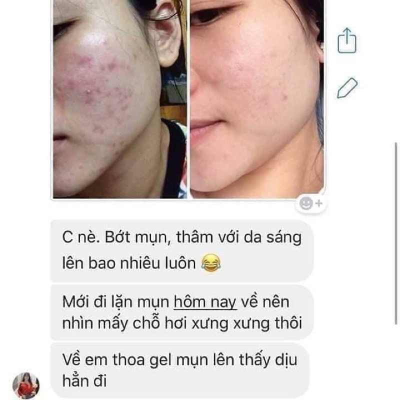 Gel mụn CENLIA 🔥[ CHÍNH HÃNG ]🔥 trả lại làn da sáng mịn sạch mụn, làm mờ thâm mụn, dứt điểm mụn hoàn toàn