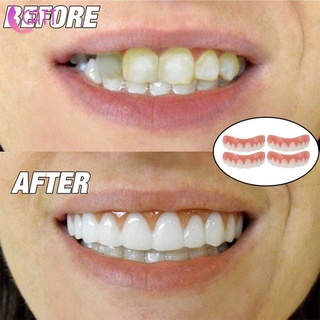 Silicone Instant Smile False Veneers Mỹ phẩm Răng Cover