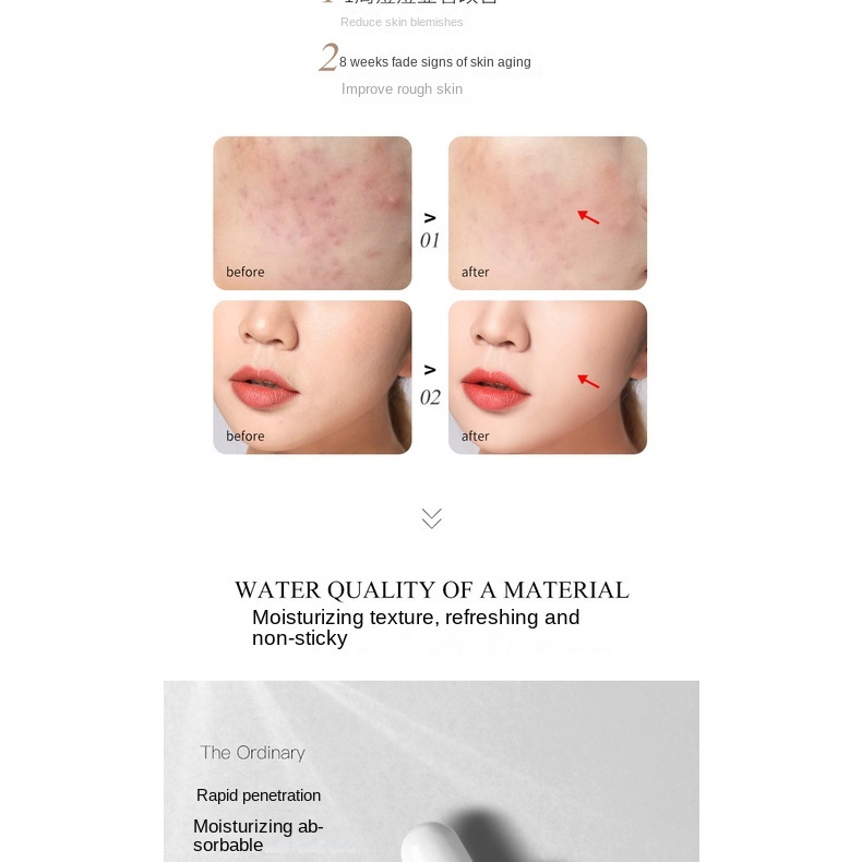 Tinh Chất Se Khít Lỗ Chân Lông Giúp Phục Hồi Sâu Cho Da Mặt