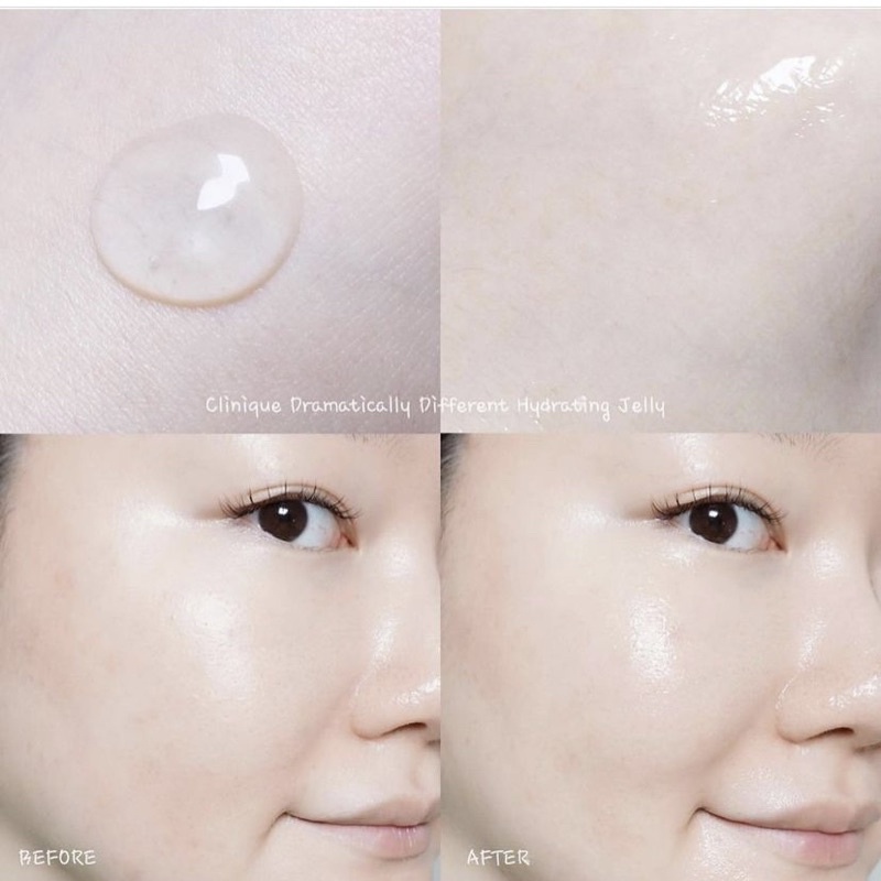 Kem dưỡng Clinique Dramatically Different Moisturizing