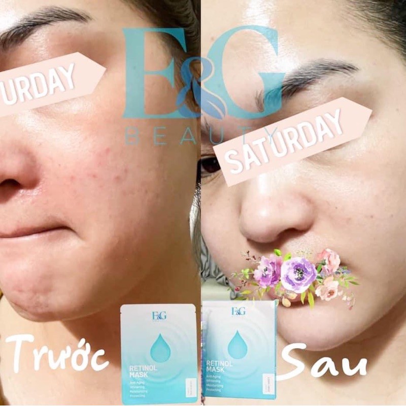 Mặt nạ chống nhăn Retinol mask | BigBuy360 - bigbuy360.vn