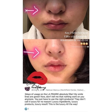 Kem dưỡng filler căng bóng La prairie