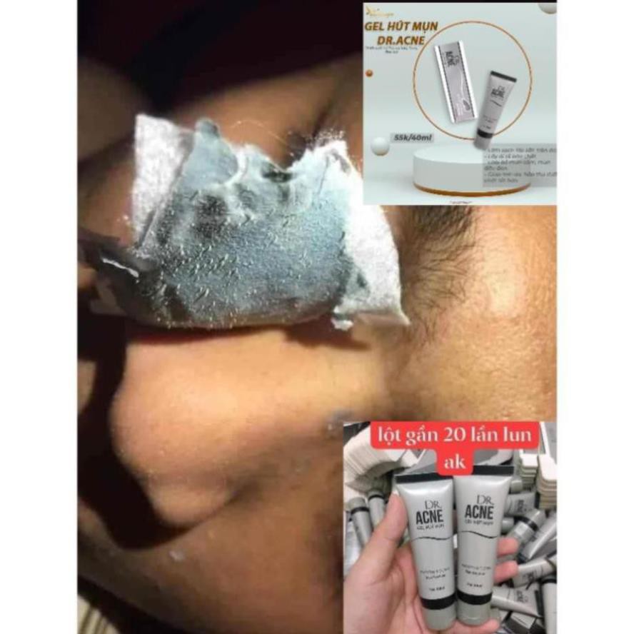 Chính Hãng- Gel Lột Mụn - DR.ACNE -  Hút sạch mụn cám, mụn đầu đen. Thải độc chì- Sáng da | BigBuy360 - bigbuy360.vn