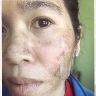 Serum Tái Tạo Trắng Da