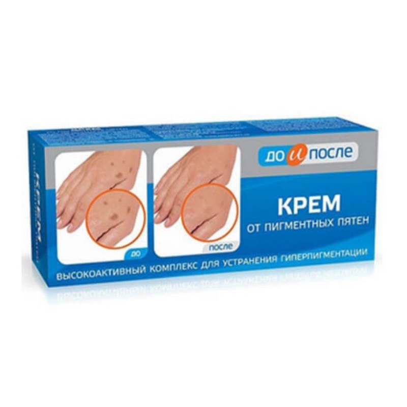 Kem Kprem tay đồi mồi của Nga 50ml