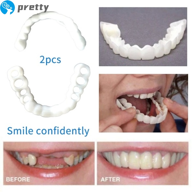 [Hàng mới về] Cặp niềng răng trắng tái sử dụng được tiện lợi
