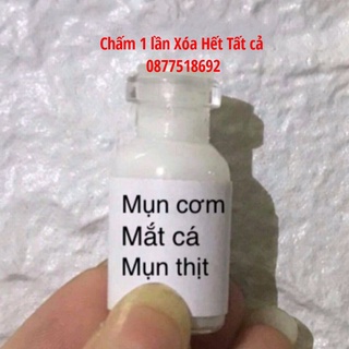 Tẩy Mụn Cóc Nốt Ruồi Tàn Nhang Mắc Cá ,Mụn Thịt