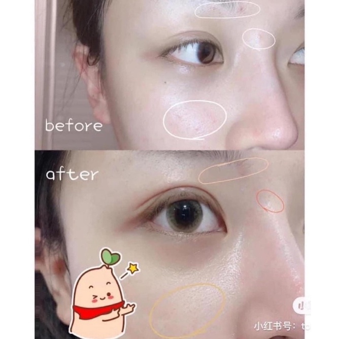 [FREE SHIP] Kem dưỡng phục hồi mờ thâm sẹo AVENE