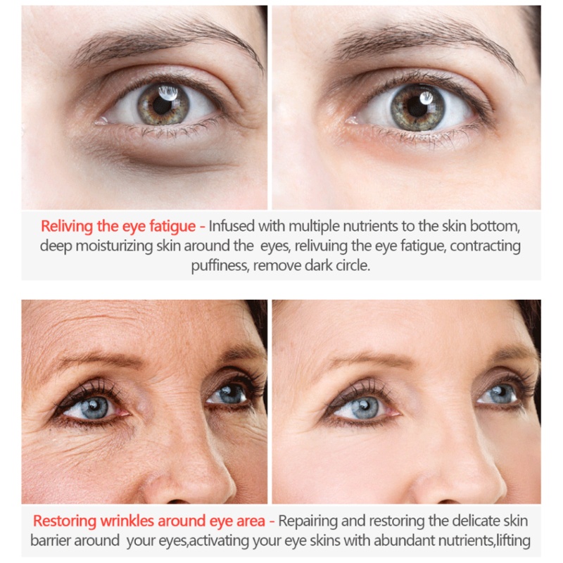 XIXI Kem dưỡng da mắt collagen chống lão hóa chống bọng mắt XIBRANT GLAMOUR
 | BigBuy360 - bigbuy360.vn