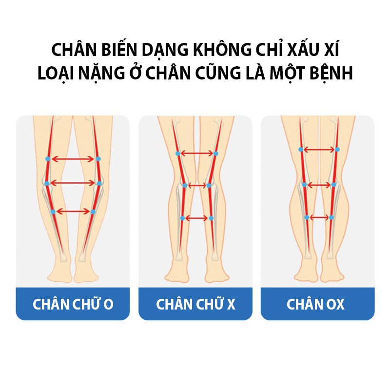 Đai Nắn Thẳng Chân Bằng Áp Suất Hơi Chữa Chân Vòng Kiềng Cho Bé Cao Cấp Jorzilano JZL-197