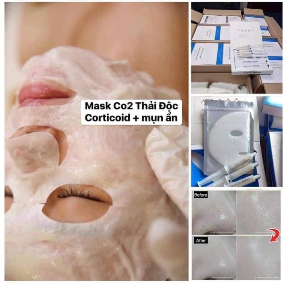 CO2 DJ Carborn Therapy ĐẶC TRỊ MỤN, GIÚP DA THẢI ĐỘC