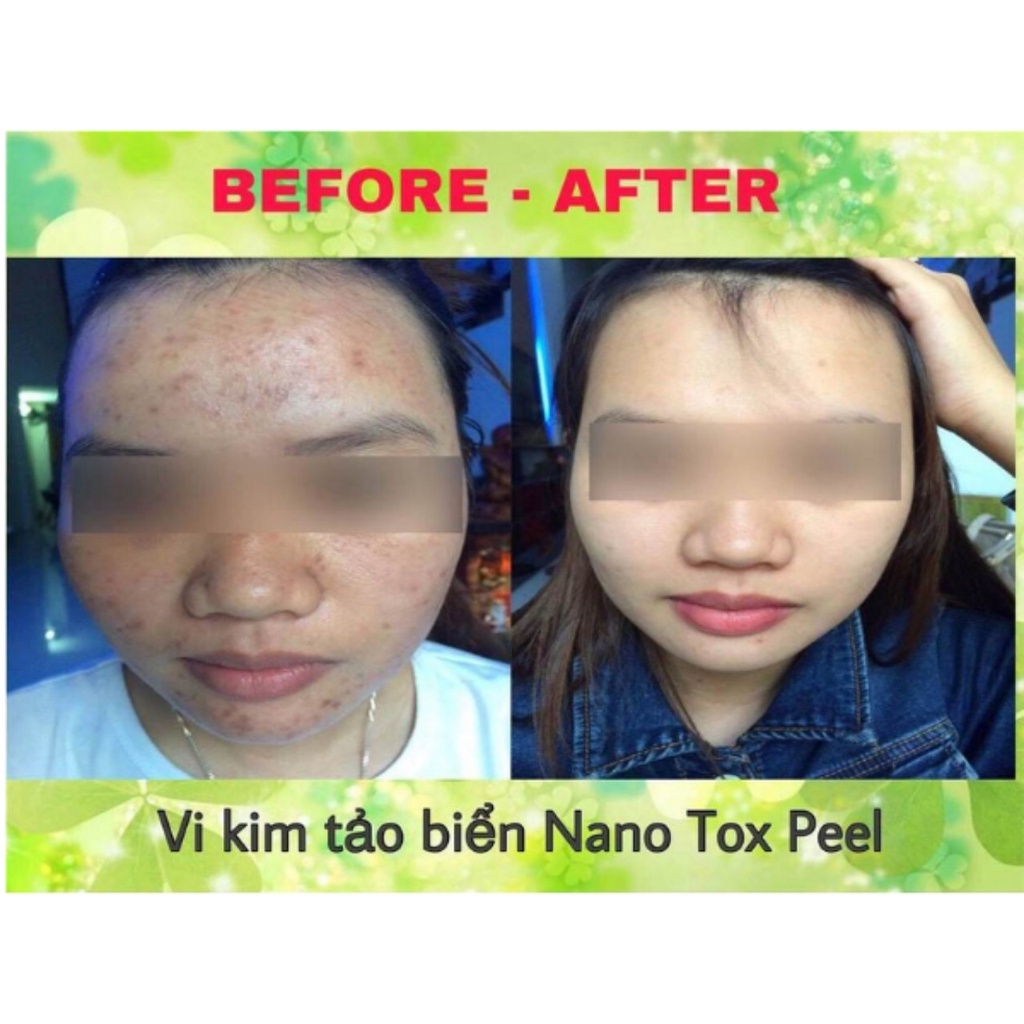 Siêu vi tảo, siêu vi kim, tảo nano tox peel dr pluscell (1 cặp)