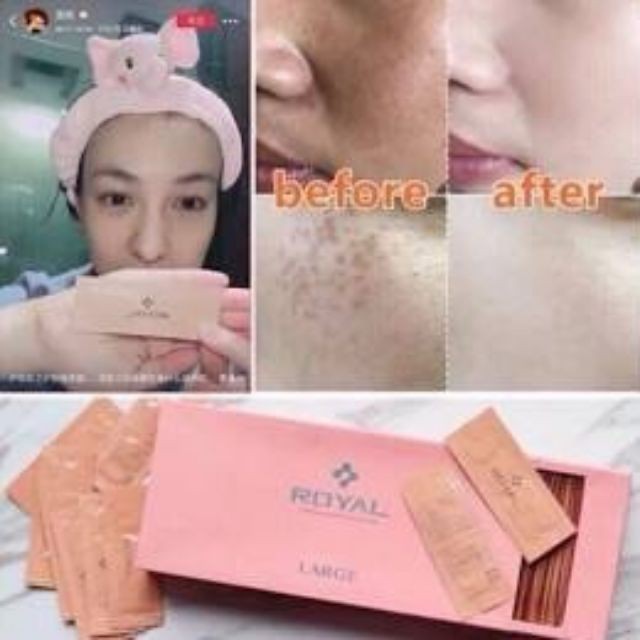 Serum dưỡng da nhau thai cừu Royal giúp làm mềm minh làn da chính hãng Nhật Bản [Bán Lẻ Theo Gói] | BigBuy360 - bigbuy360.vn
