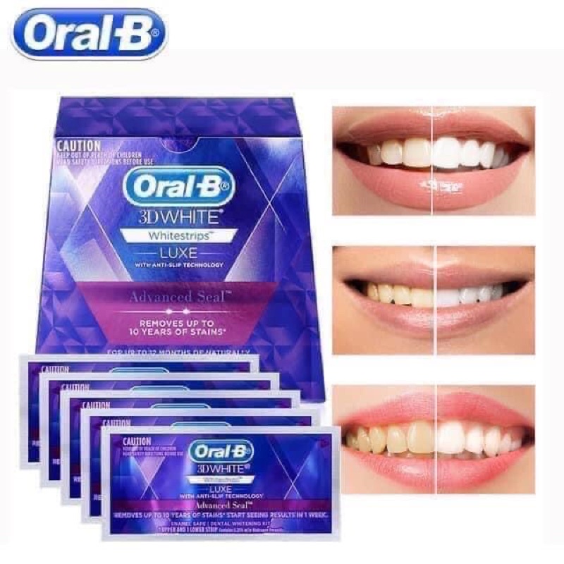 Miếng Dán Trắng Răng Oral B 3D White Tách Lẻ 1 Gói (2 Miếng)