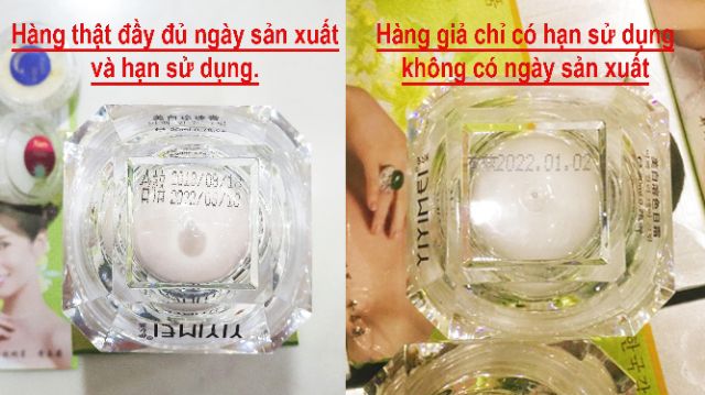 [SIÊU SALE] Bộ mỹ phẩm Yiyimei 5in1, chuyên làm sạch nám, tàn nhang và dưỡng trắng da, kem nám Yiyimei, mỹ phẩm Yiyimei.