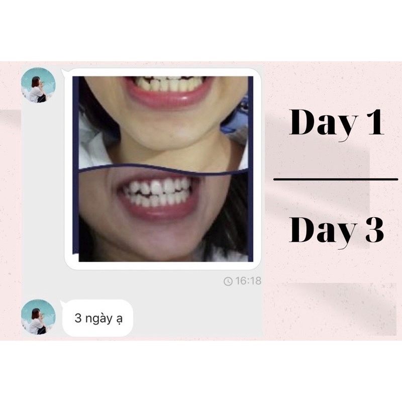 [ 1 GÓI lẻ ] Miếng dán trắng răng ❤ FREESHIP ❤ Miếng dán Crest 3D White Whitestrips [Hàng Mỹ] - trắng răng Crest