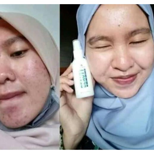 11.11|R-1262||Xịt Vẻ Đẹp Tự Nhiên 100% Nguyên Bản | BigBuy360 - bigbuy360.vn