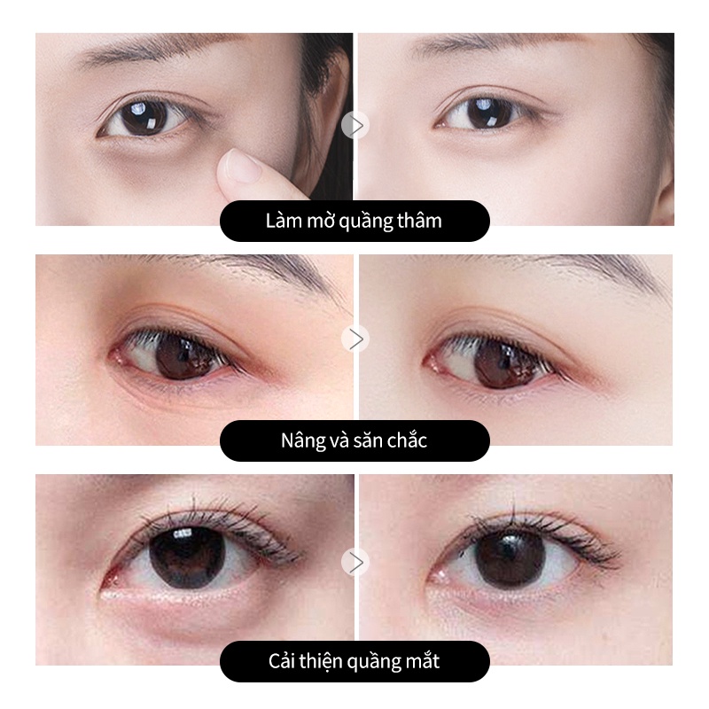 Kem dưỡng da vùng mắt Honey&Beauty hạn chế quầng thâm và bọng mắt hiệu quả cao 15g | BigBuy360 - bigbuy360.vn