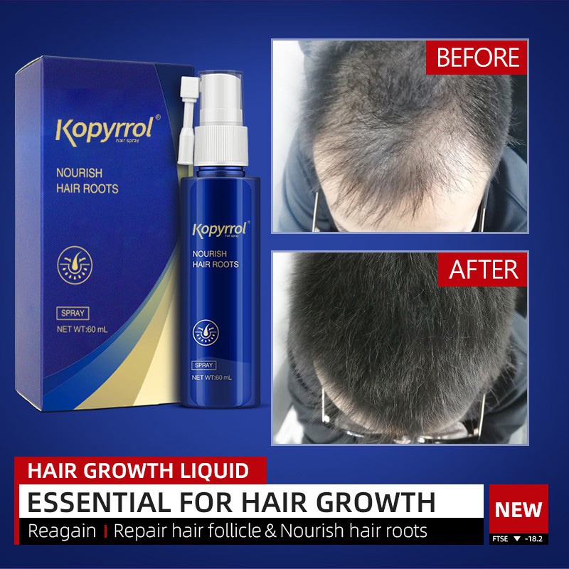 Tinh chất KOPYRROL kích thích mọc tóc dung tích 90ml