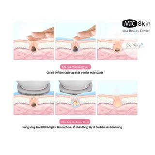 Máy rửa mặt đa chức năng Lisa Beauty Device MTC