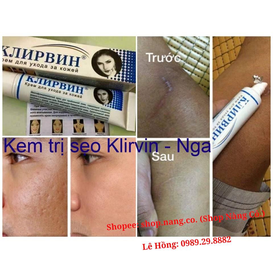 Kem Sẹo Nga Klirvin - Xóa sẹo, thâm, rạn da... Giúp phục hồi các tổn thương trên da, thúc đẩy tái tạo da