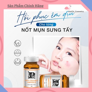 Serum Mụn Anti Trouble Ampoule 5ml/Chai