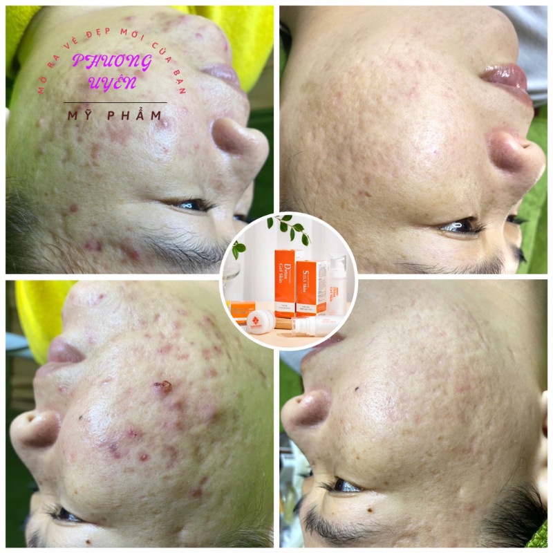 Gel massage mặt 50g ⚡ CHÍNH HÃNG ⚡ Giúp loại bỏ dầu và bụi bẩn cho da, làm sạch lỗ chân lông, ngăn ngừa mụn.