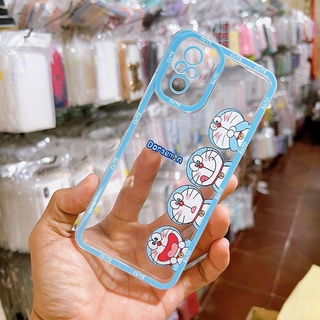 Ốp lưng lỗ viền camera Xiaomi Redmi Note 10 Note 10s Note 11 Note11s Note 10 Pro Note 11 Pro 4G Redmi 10A Redmi 9C