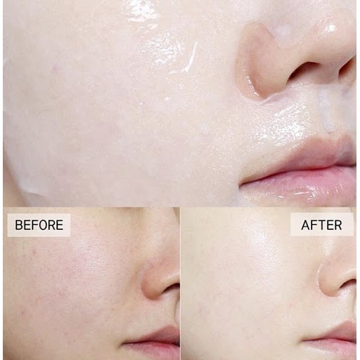 Mặt Nạ Dưỡng Da Chuyên Biệt Mediheal Essential Mask