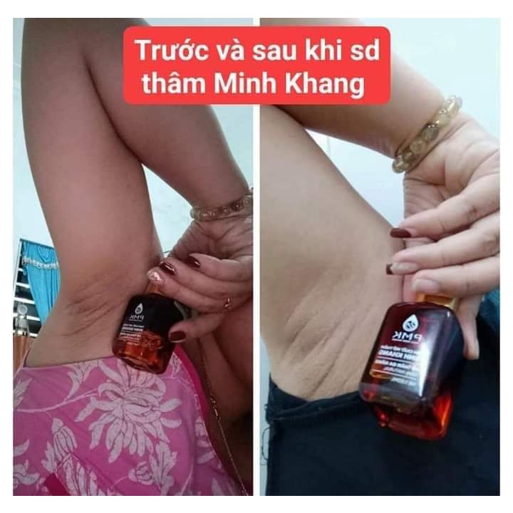 Tinh chất Xóa mờ thâm Minh Khang- Xoá thâm Sẹo,thâm mắt, thâm môi,thâm nách,thâm mụn,thâm gãi ngứa - Chính Hãng