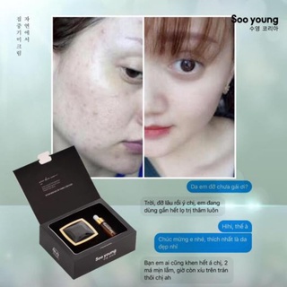 [Chín hãng] Combo kem face và serum mụn Soo Young