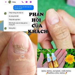 phục hồi móng hư tổn