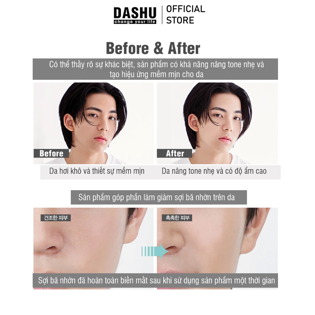 Tinh chất/sữa dưỡng da nam dành cho da dầu Dashu Aqua Deep Waterfull All In One Lotion 153ml