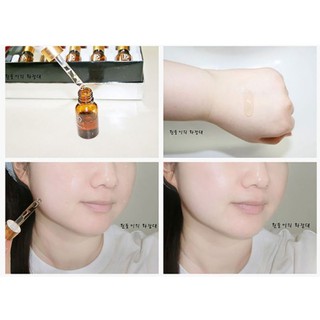 Tế Bào Gốc Nọc Ong Propolis Myrrh Ample