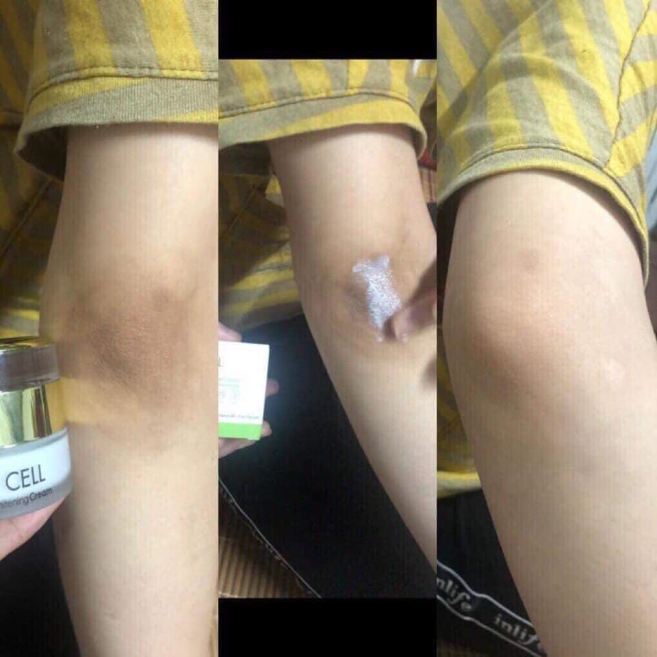 Hộp Kem Tri Thâm Nách Thâm Môi Thâm Đầu Gối OL-CELL