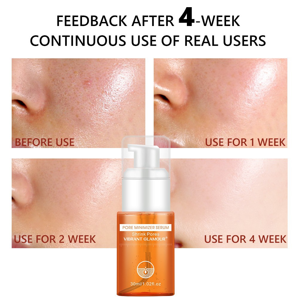 Serum Thu Nhỏ Lỗ Chân Lông VIBRANT GLAMOUR Giảm Mụn Đầu Đen Dưỡng Ẩm Làm Săn Chắc Mịn Da Axit Hyaluronic/Salicylic 30ml | BigBuy360 - bigbuy360.vn