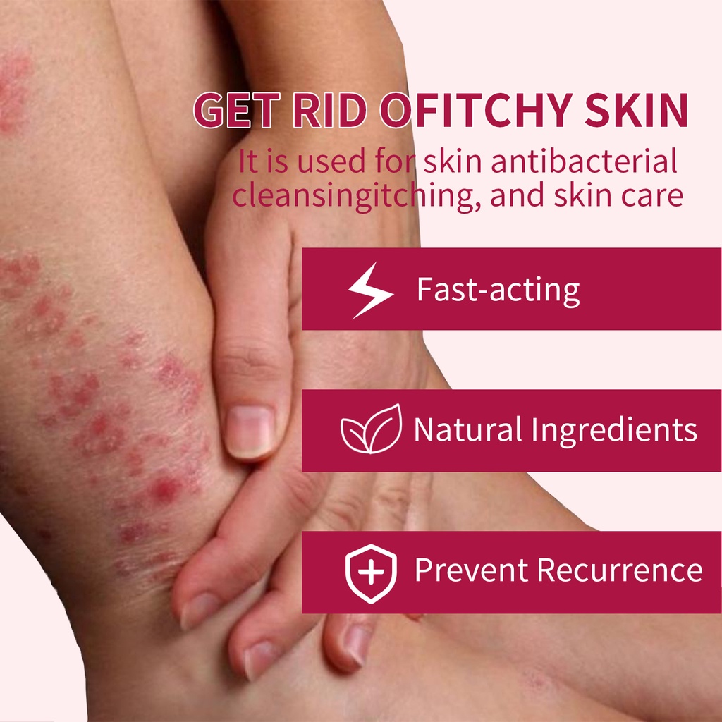 Khử mùi chống ngứa Sữa tắm / làm trắng da / diệt ve / kháng khuẩn cho da