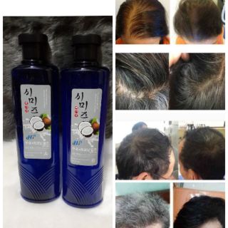 THUỐC NGUỒN GỐC THẢO DƯỢC - THÂN THIỆN VỚI NGƯỜI DÙNG , KO ĐỘC HẠI .
👌 Nhuộm Đen ăn bạc 100% .