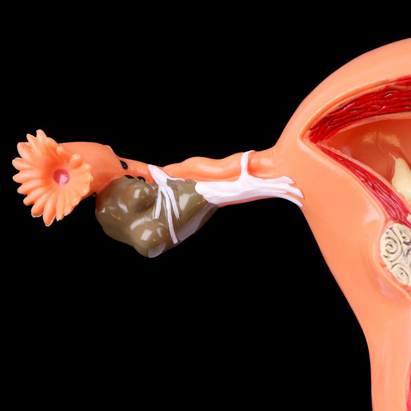 Wer Mô Hình Giải Phẫu Uterus Ovary Cho Học Sinh