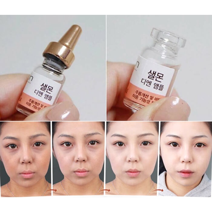 1 Ống Tinh Chất Tế Bào Gốc Từ DNA Cá Hồi Phục Hồi Da Sau 28 Ngày Suiskin 2ml